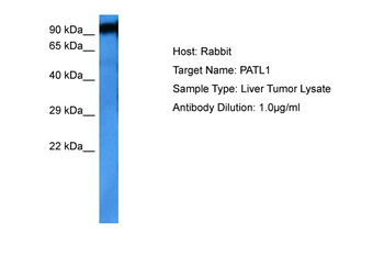 PATL1 Rabbit Polyclonal Antibody