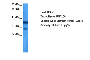 RNF208 Rabbit Polyclonal Antibody