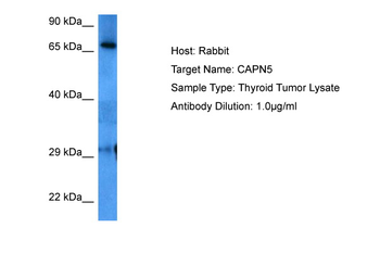 CAPN5 Rabbit Polyclonal Antibody