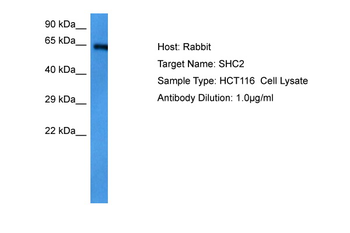 SHC2 Rabbit Polyclonal Antibody