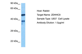 ZDHHC9 Rabbit Polyclonal Antibody