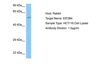 EIF2B4 Rabbit Polyclonal Antibody