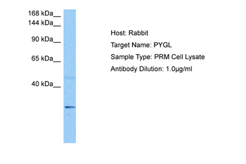 PYGL Rabbit Polyclonal Antibody