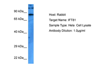 IFT81 Rabbit Polyclonal Antibody