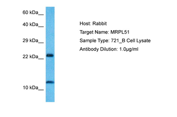 MRPL51 Rabbit Polyclonal Antibody