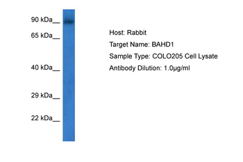 BAHD1 Rabbit Polyclonal Antibody