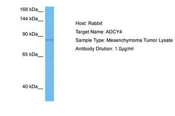 ADCY4 Rabbit Polyclonal Antibody