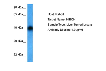 HIBCH Rabbit Polyclonal Antibody