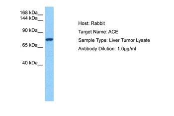 ACE Rabbit Polyclonal Antibody