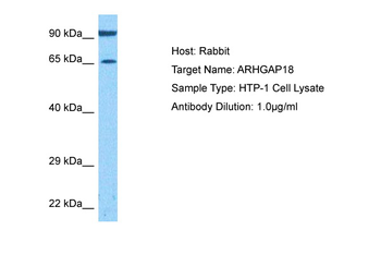 ARHGAP18 Rabbit Polyclonal Antibody