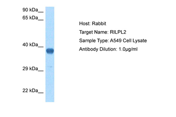 RILPL2 Rabbit Polyclonal Antibody