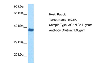 MC3R Rabbit Polyclonal Antibody