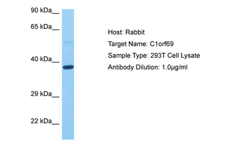 IBA57 Rabbit Polyclonal Antibody