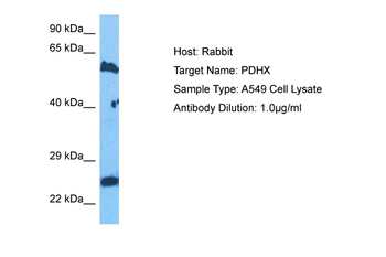 PDHX Rabbit Polyclonal Antibody