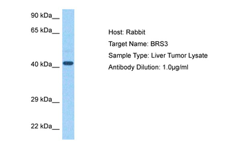 BRS3 Rabbit Polyclonal Antibody