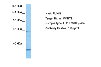 KCNT2 Rabbit Polyclonal Antibody