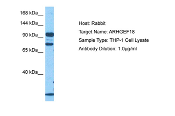 ARHGEF18 Rabbit Polyclonal Antibody
