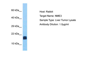 NME3 Rabbit Polyclonal Antibody