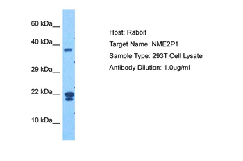 NME2 Rabbit Polyclonal Antibody