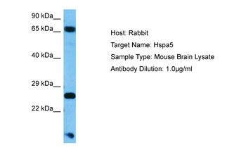 HSPA5 Rabbit Polyclonal Antibody
