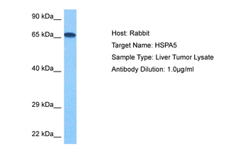 HSPA5 Rabbit Polyclonal Antibody