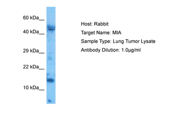 MIA Rabbit Polyclonal Antibody