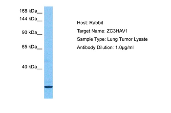ZC3HAV1 Rabbit Polyclonal Antibody