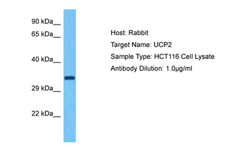 UCP2 Rabbit Polyclonal Antibody