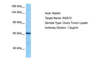 RGS12 Rabbit Polyclonal Antibody