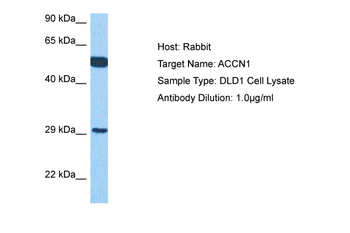 ASIC2 Rabbit Polyclonal Antibody