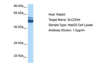 SLC22A4 Rabbit Polyclonal Antibody