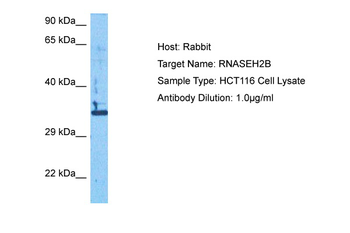 RNASEH2B Rabbit Polyclonal Antibody