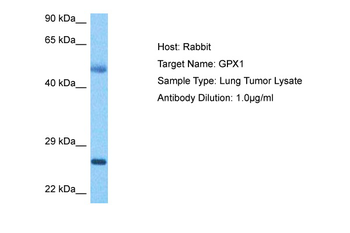GPX1 Rabbit Polyclonal Antibody