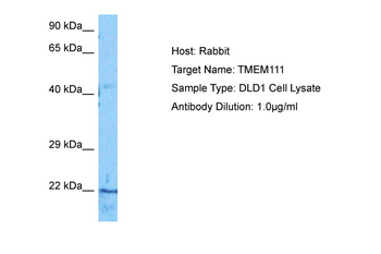 EMC3 Rabbit Polyclonal Antibody