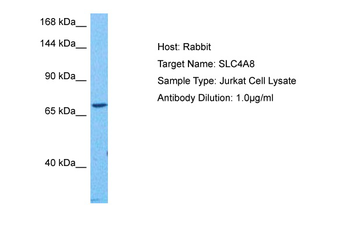 SLC4A8 Rabbit Polyclonal Antibody