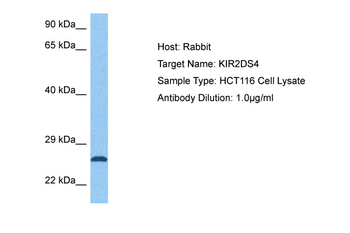 KIR2DS4 Rabbit Polyclonal Antibody