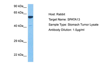 SPATA13 Rabbit Polyclonal Antibody