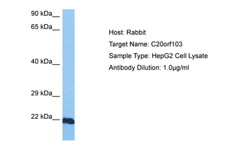 LAMP5 Rabbit Polyclonal Antibody