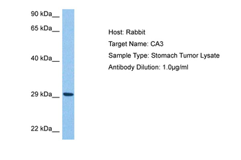CA3 Rabbit Polyclonal Antibody