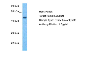LMBRD1 Rabbit Polyclonal Antibody