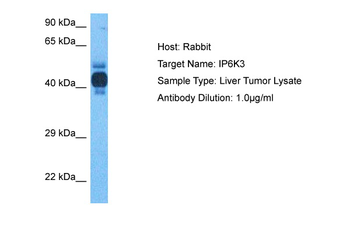 IP6K3 Rabbit Polyclonal Antibody
