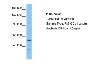 ZNF106 Rabbit Polyclonal Antibody