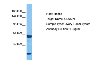 CLASP1 Rabbit Polyclonal Antibody