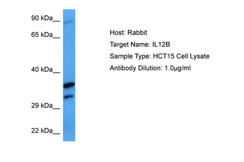 IL12B Rabbit Polyclonal Antibody