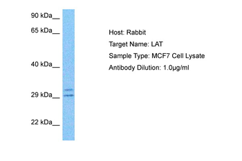 LAT Rabbit Polyclonal Antibody