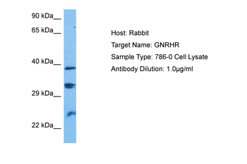 GNRHR Rabbit Polyclonal Antibody
