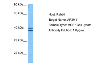 AP3M1 Rabbit Polyclonal Antibody