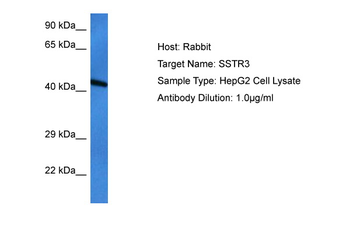 SSTR3 Rabbit Polyclonal Antibody