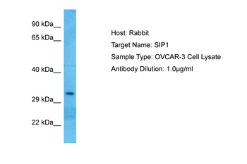 GEMIN2 Rabbit Polyclonal Antibody