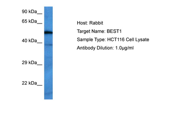BEST1 Rabbit Polyclonal Antibody